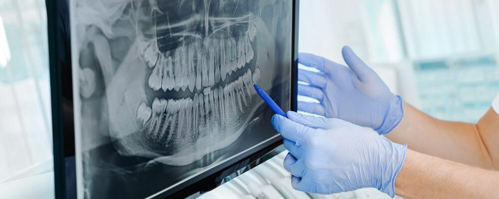 Indiana dentistry license defense lawyer for dentists and dental hygienists